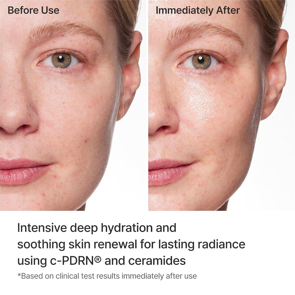 REJURAN® Turnover Mask, c-PDRN® (5ea) – Original Salmon DNA for Firming, Hydration, Repairing & Revitalizing. Achieve Youthful, Radiant Skin. Korean Skincare. Ultra Microfiber Sheet Mask
